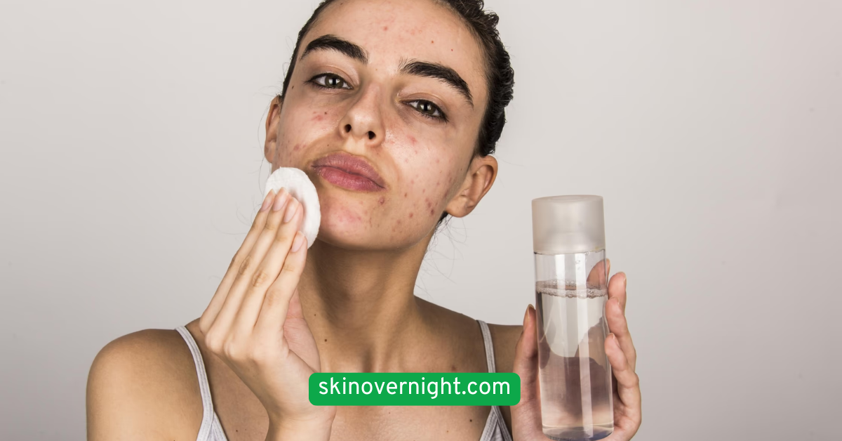 Avoid Heavy or Pore-Clogging Products