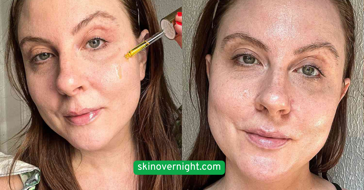  Incorporate Facial Oils for Extra Hydration