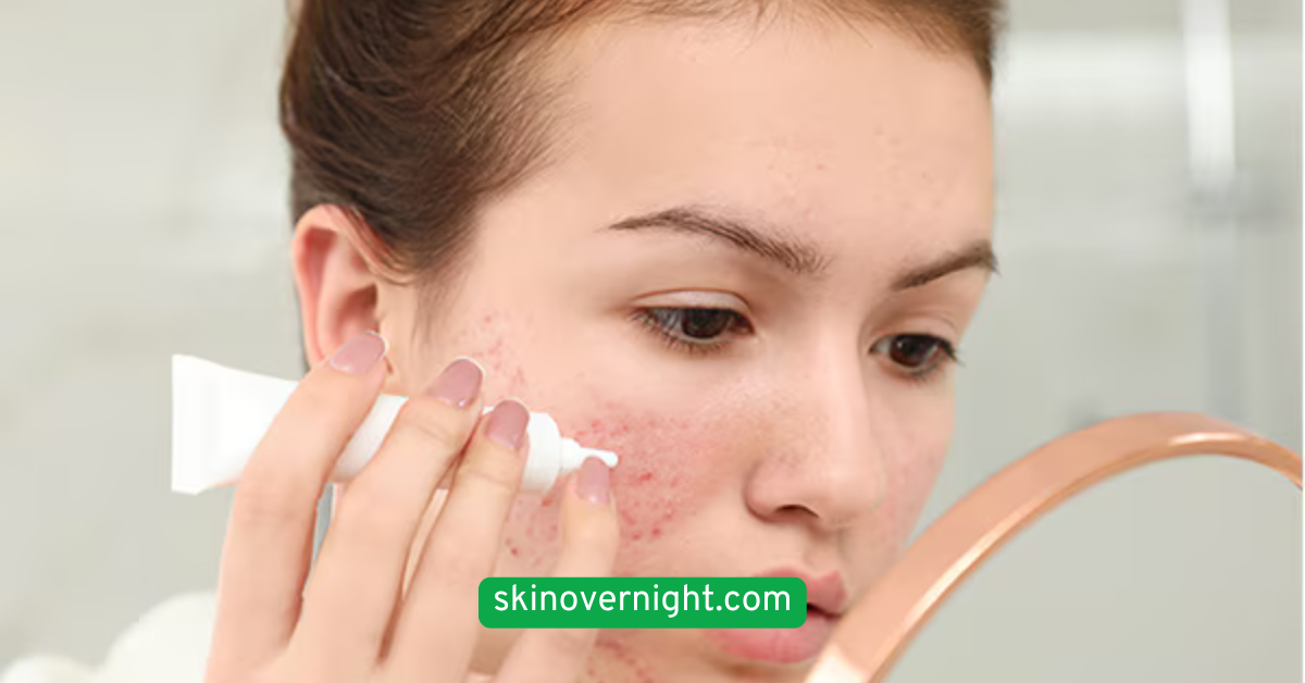 Apply Spot Treatment as Needed