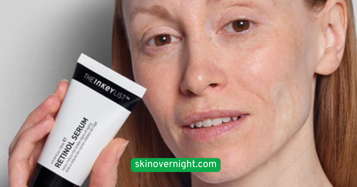 Try a Retinol or Retinoid Treatment