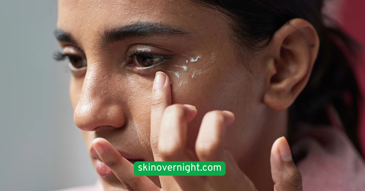 Treat Under-Eyes with a Nourishing Eye Cream