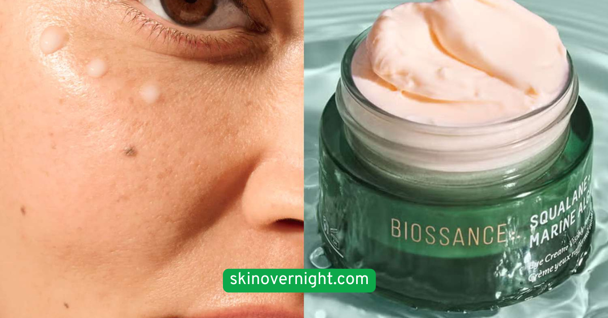 Use a Calming Eye Cream or Gel